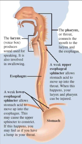 Gastro Oesophageal Reflux Disease diagram