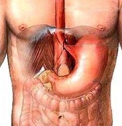 Reflux Surgery